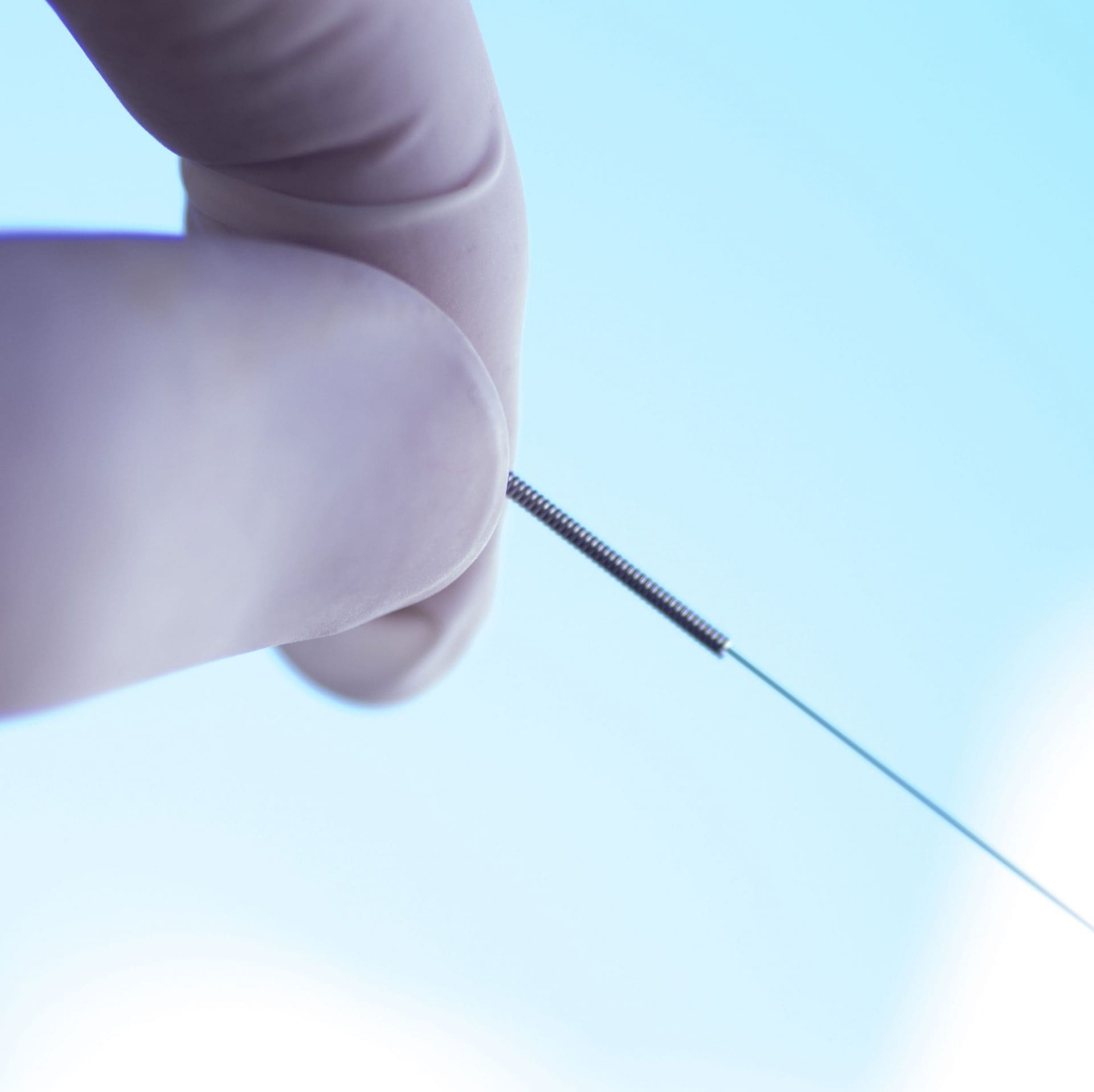 Een dun naaldje voor dry needling tussen gehandschoende vingers
